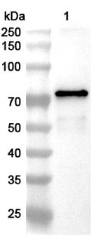 Vibrio cholerae serotype O1 RctB Polyclonal Antibody