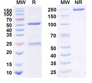 Human KRT7 Monoclonal Antibody