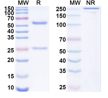 Human FSCN1 Monoclonal Antibody