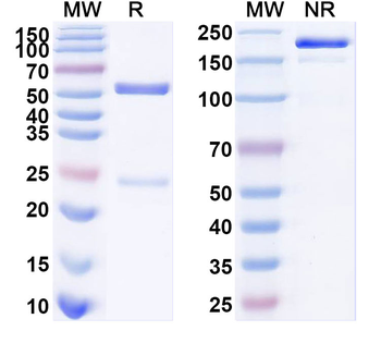 Human Calretinin/CALB2 Monoclonal Antibody