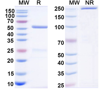Human Calretinin/CALB2 Monoclonal Antibody