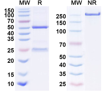 Human Calretinin/CALB2 Monoclonal Antibody