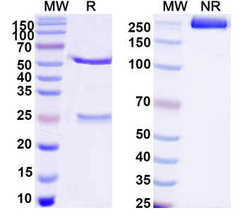Human SLC22A2/OCT2 Monoclonal Antibody