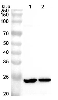 Human ATP5PB Polyclonal Antibody