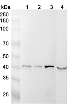 BCKDK Polyclonal Antibody