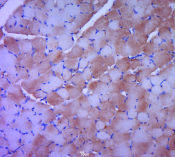 Creatine Kinase MM Rabbit Polyclonal Antibody