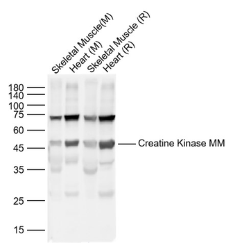 Creatine Kinase MM Rabbit Polyclonal Antibody