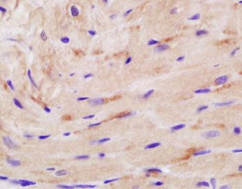 Creatine Kinase MM Rabbit Polyclonal Antibody