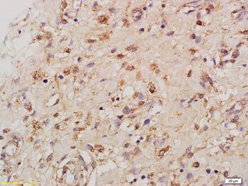 TNF alpha Rabbit Polyclonal Antibody