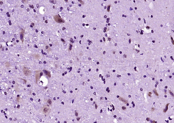 GRK5 Rabbit Polyclonal Antibody