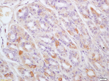 TPST1 Rabbit Polyclonal Antibody