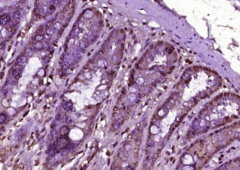 RPS6KB1 Rabbit Polyclonal Antibody