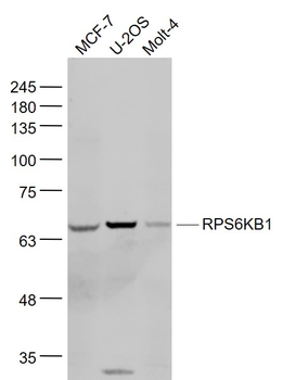 RPS6KB1 Rabbit Polyclonal Antibody