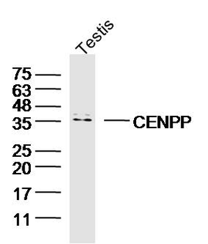 CENPP Rabbit Polyclonal Antibody