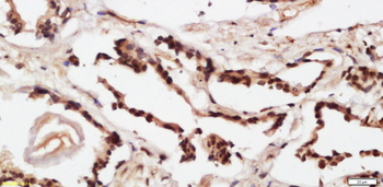 CENPP Rabbit Polyclonal Antibody