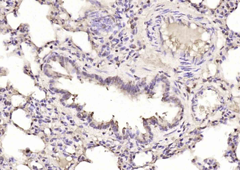 SMC6 Rabbit Polyclonal Antibody