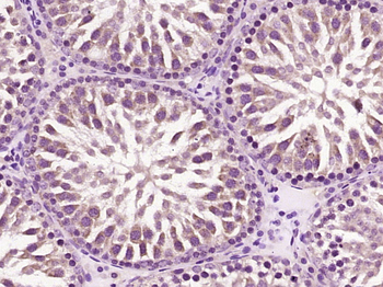 CCDC11 Rabbit Polyclonal Antibody