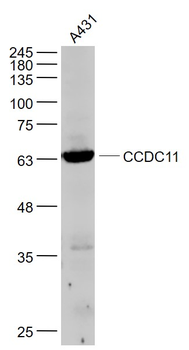 CCDC11 Rabbit Polyclonal Antibody