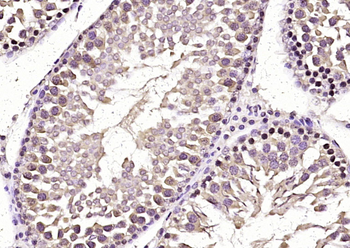 CAPH Rabbit Polyclonal Antibody