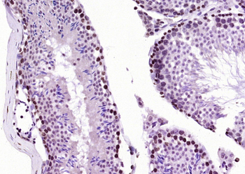 CIRBP Rabbit Polyclonal Antibody