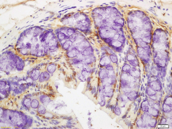 CIRBP Rabbit Polyclonal Antibody