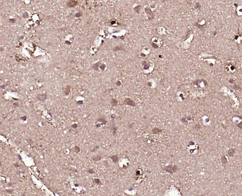 DUSP26 Rabbit Polyclonal Antibody
