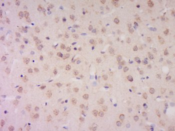 AMN1 Rabbit Polyclonal Antibody