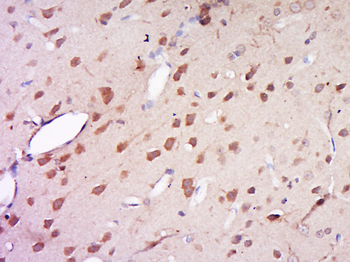 AMN1 Rabbit Polyclonal Antibody