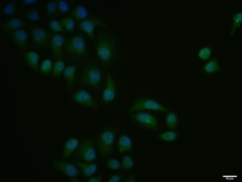 NF1 Rabbit Polyclonal Antibody