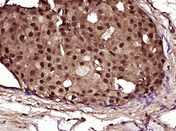 NF1 Rabbit Polyclonal Antibody