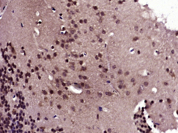 NF1 Rabbit Polyclonal Antibody