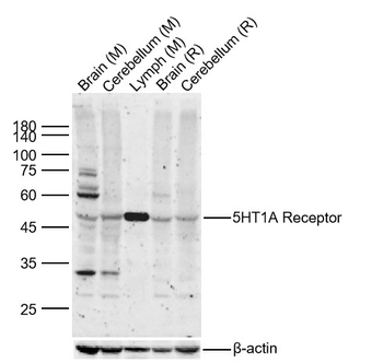 5HT1A Receptor Rabbit Polyclonal Antibody