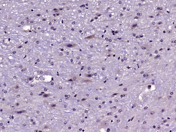 Nck beta Rabbit Polyclonal Antibody