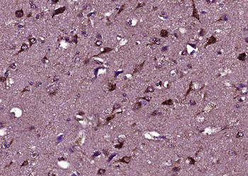 HEPACAM Rabbit Polyclonal Antibody