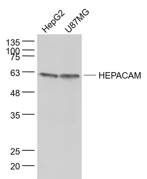 HEPACAM Rabbit Polyclonal Antibody