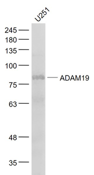ADAM19 Rabbit Polyclonal Antibody