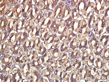 CDCP1 Rabbit Polyclonal Antibody