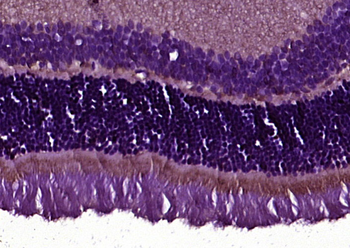 Lumican Rabbit Polyclonal Antibody