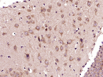 ADORA2B Rabbit Polyclonal Antibody