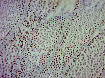 RAD54B Rabbit Polyclonal Antibody