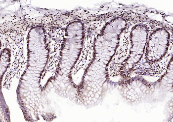 MYBL2 Rabbit Polyclonal Antibody