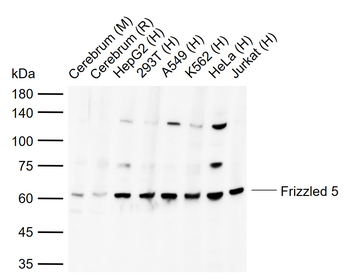 Frizzled 5 Rabbit Polyclonal Antibody