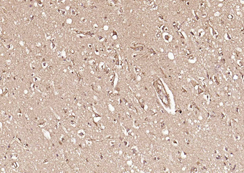 Frizzled 5 Rabbit Polyclonal Antibody