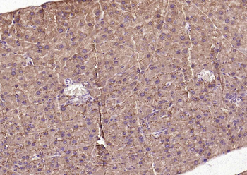Frizzled 5 Rabbit Polyclonal Antibody
