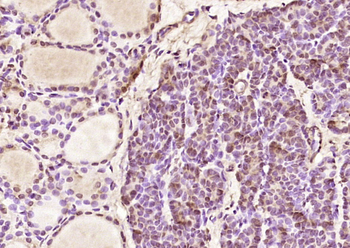 LUCA15 Rabbit Polyclonal Antibody