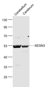 SESN3 Rabbit Polyclonal Antibody