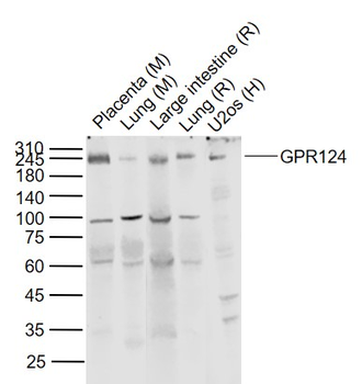 GPR124 Rabbit Polyclonal Antibody