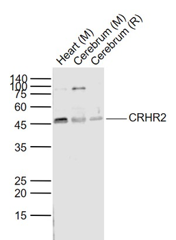 CRHR2 Rabbit Polyclonal Antibody
