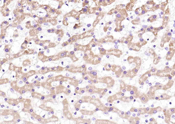 IGF2R/M6PR Rabbit Polyclonal Antibody