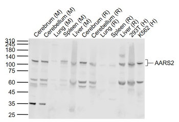 AARS2 Rabbit Polyclonal Antibody